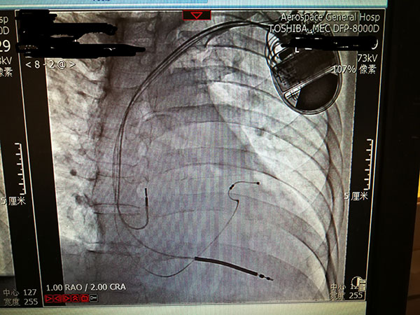 心內(nei)科(ke)新(xin)技(ji)術(shù)照片1_副本(ben).jpg 心內(nei)科(ke)新(xin)技(ji)術(shù)照片1_副本(ben).jpg
